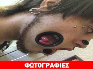 Φρίκη: Έκανε Εxtreme Piercing Ώστε Να Έχει Στόμα Και Στο Μάγουλο - ΦΩΤΟ